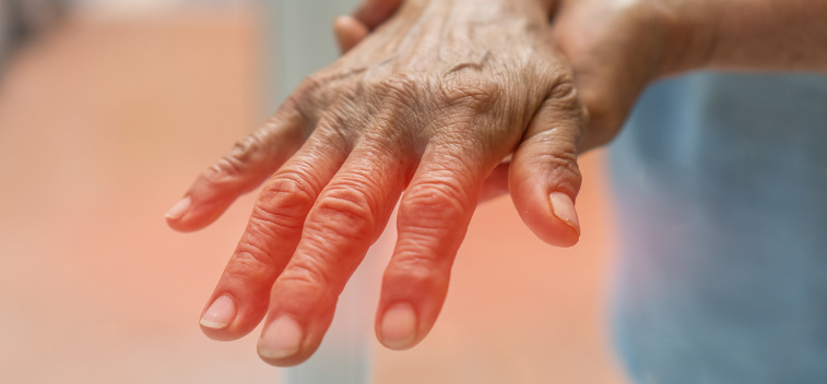 patient experiencing Stabbing & Burning Pain and in need of the neuropathy treatment protocol at Smith Family Chiropractic Wellness Center in Campbell